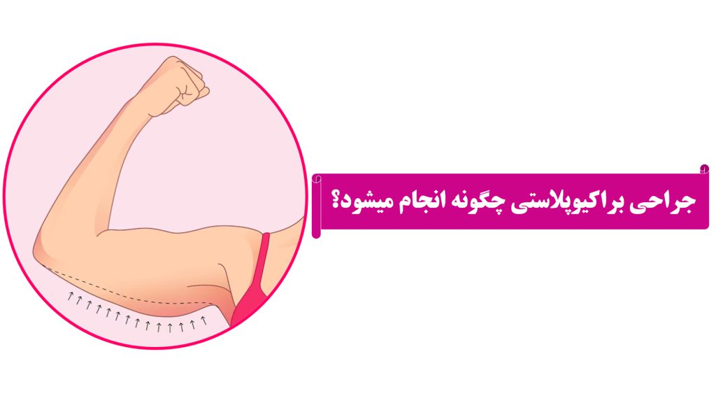 https://api.icib.co/files/1730190666_FF2iIRo5aB9s8dIQ30WJAZ3eagH3ByKYHH7DZEj1.jpg