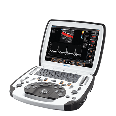 Dispositivo ecografico portatile uSmart 3300