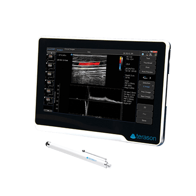 Dispositivo ecografico portatile uSmart 3200T
