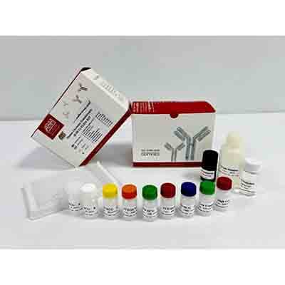 Schnelltest-Kit für enzymatische Immunanalyse ß-HCG
