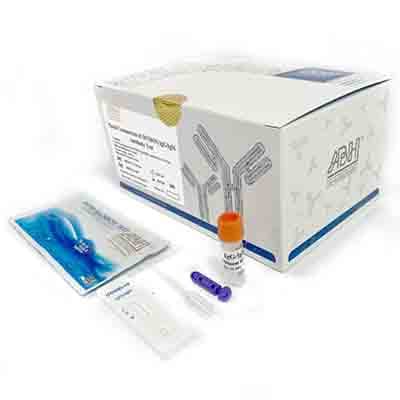 Schnelltest-Kit für die Antikörper IgG und IgM des Coronavirus