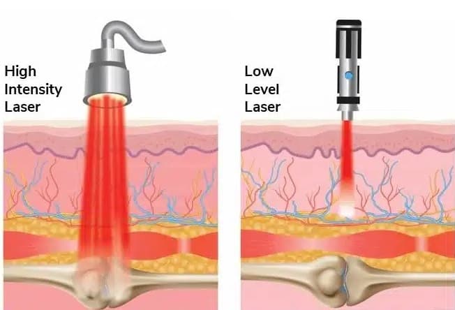 Biologische Effekte der Lasertherapie